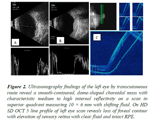 clinical-ophthalmology-vision-science-smooth-contoured