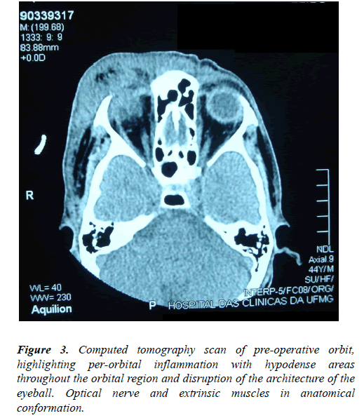 clinical-ophthalmology-vision-science-tomography