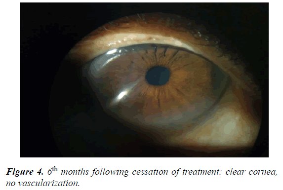 clinical-ophthalmology-vision-science-vascularization