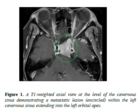 clinical-ophthalmology-vision-science-weighted-axial