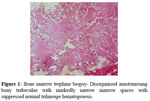 clinical-pathology-Bone-marrow