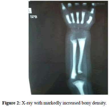 clinical-pathology-bony-density