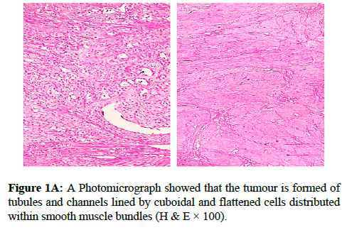 clinical-pathology-flattened-cells