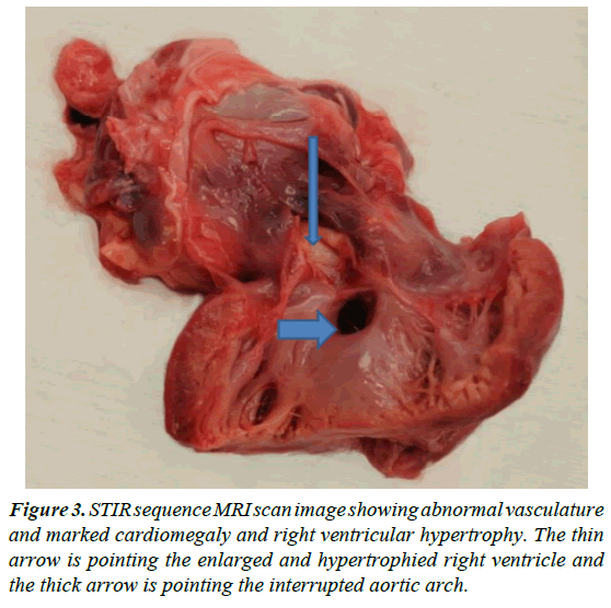 clinical-pathology-laboratory-medicine-abnormal-vasculature-marked