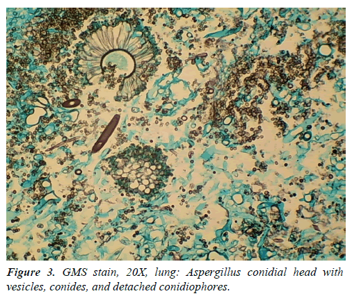 clinical-pathology-laboratory-medicine-conidiophores