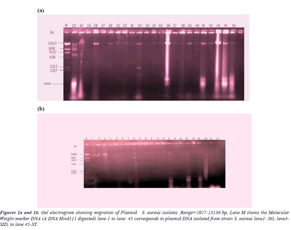 clinical-pathology-laboratory-medicine-electrogram-showing-migration-Plasmid