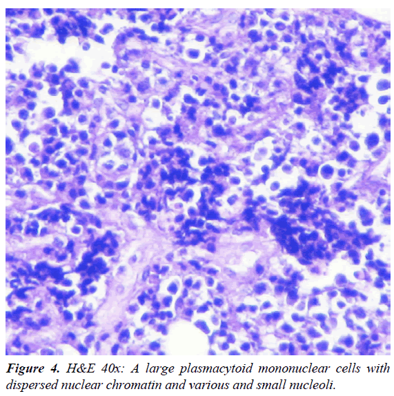 clinical-pathology-laboratory-medicine-large-plasmacytoid