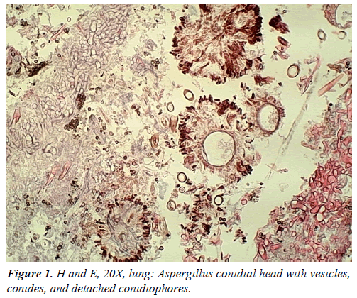 clinical-pathology-laboratory-medicine-lung