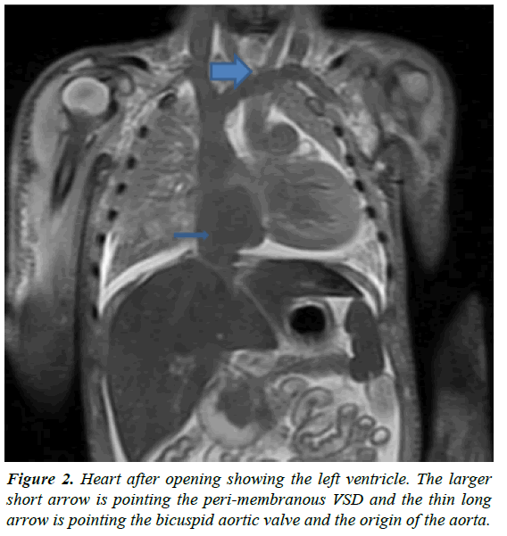 clinical-pathology-laboratory-medicine-pointing-peri-membranous