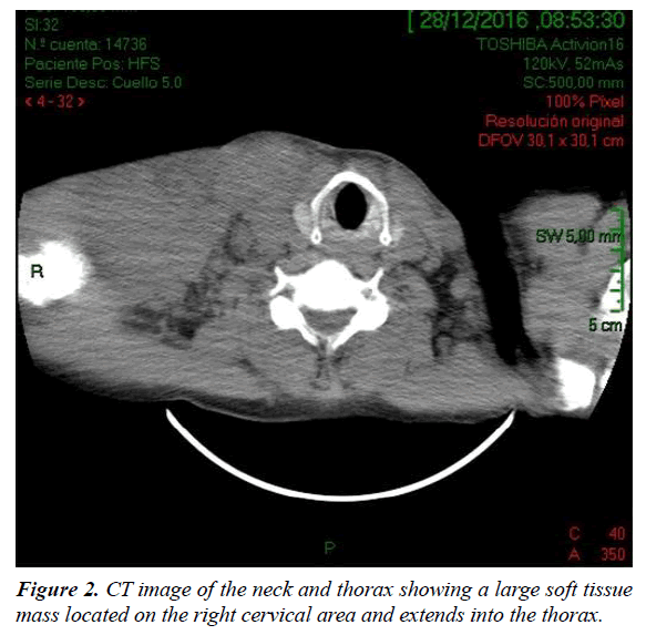 clinical-pathology-laboratory-medicine-thorax-showing