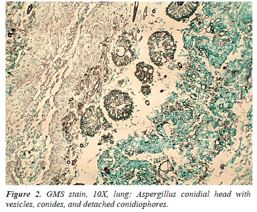 clinical-pathology-laboratory-medicine-vesicles-conides