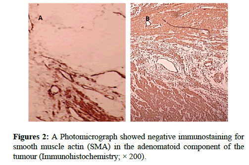 clinical-pathology-muscle-actin