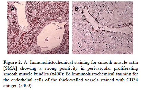 clinical-pathology-muscle-bundles