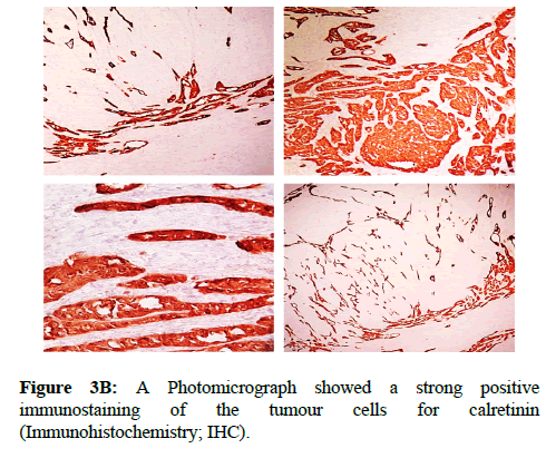 clinical-pathology-strong-positive