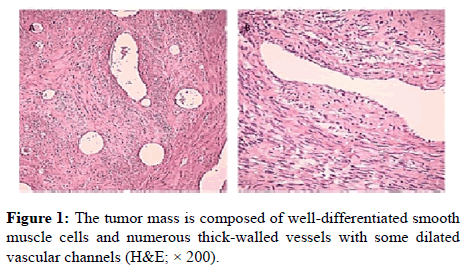 clinical-pathology-tumor-mass