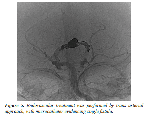 cognitive-neuroscience-endovascular