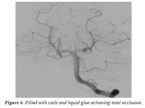 cognitive-neuroscience-liquid-glue