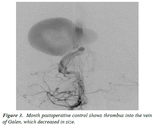 cognitive-neuroscience-postoperative