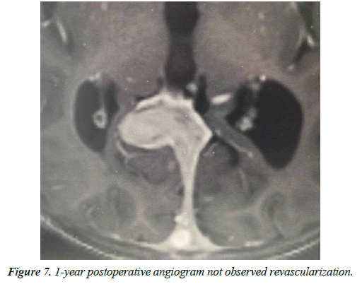 cognitive-neuroscience-revascularization