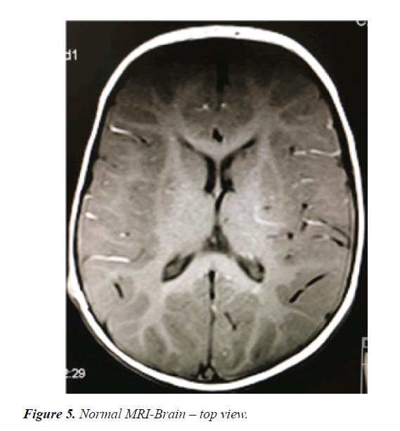 current-pediatric-research-MRI-Brain
