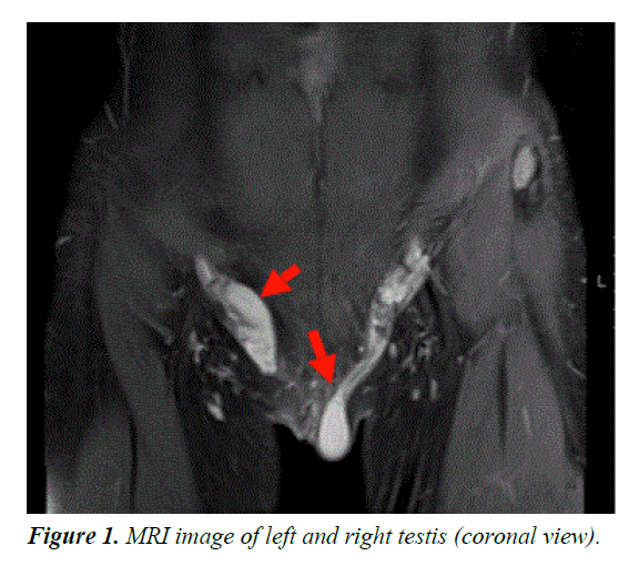 current-pediatric-research-MRI-image