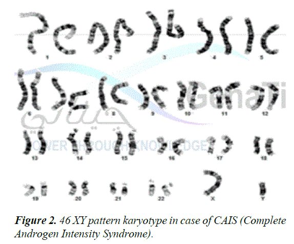 current-pediatric-research-XY-pattern