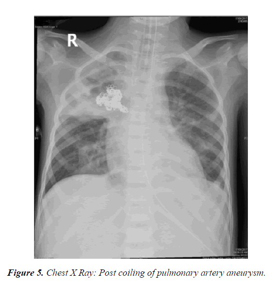 current-pediatric-research-artery-aneurysm