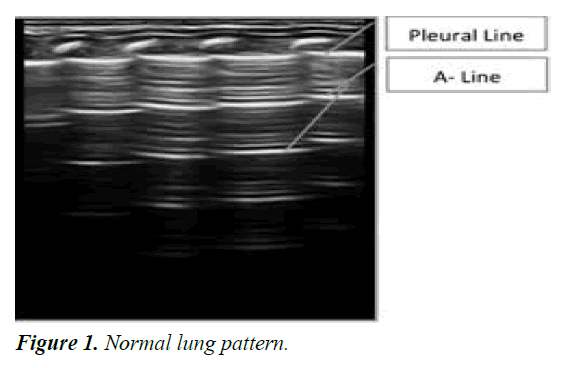 current-pediatric-research-lung-pattern