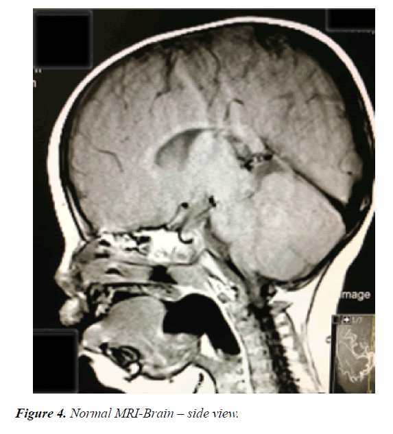 current-pediatric-research-side-view