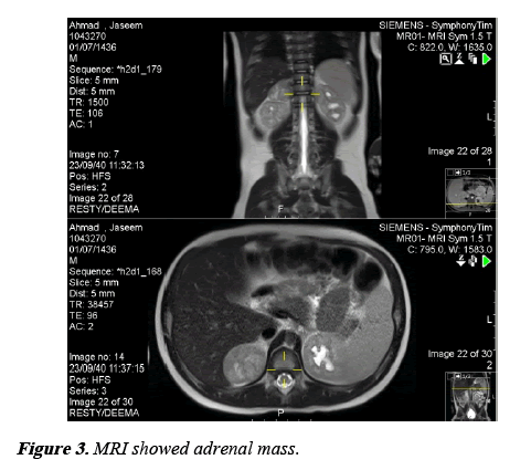 current-pediatrics-adrenal