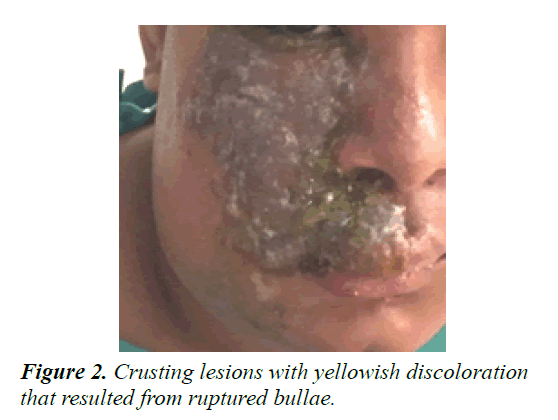 current-pediatrics-discoloration