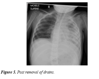 current-pediatrics-drains