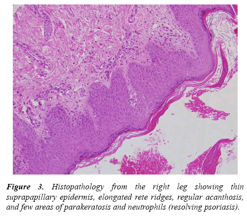 current-pediatrics-epidermis