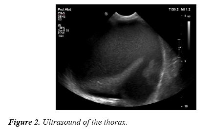 current-pediatrics-thorax