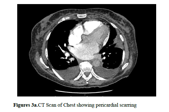 current-trends-cardiology-CT-Scan
