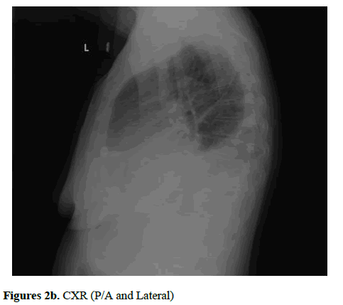 current-trends-cardiology-CXR