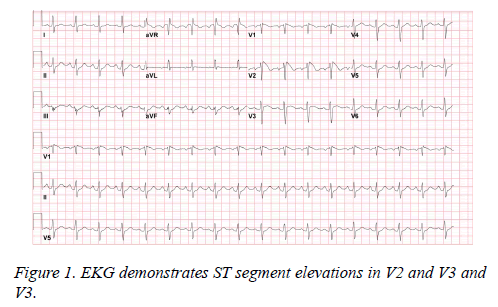 current-trends-cardiology-EKG-demonstrates