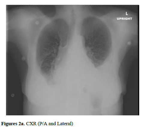 current-trends-cardiology-Lateral