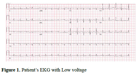 current-trends-cardiology-Low-voltage