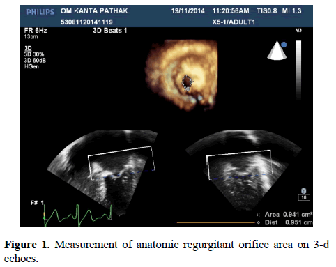 current-trends-cardiology-Measurement-anatomic