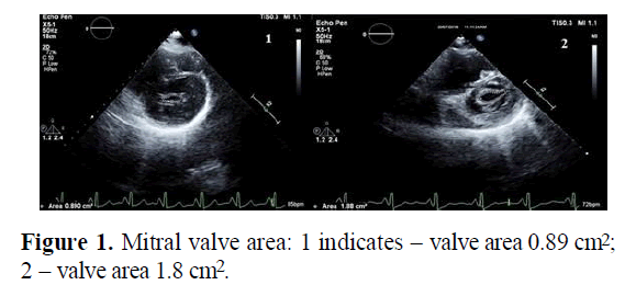 current-trends-cardiology-Mitral