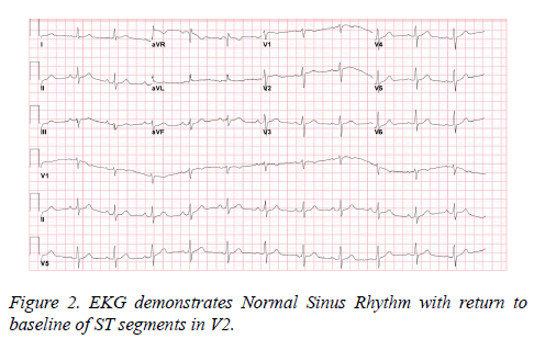 current-trends-cardiology-Normal-Sinus