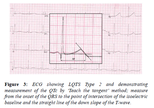 current-trends-cardiology-Teach-tangent