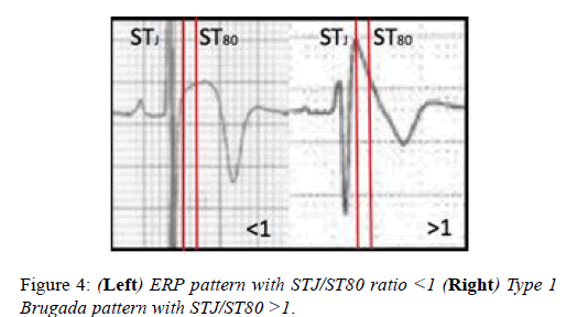 current-trends-cardiology-Teach-tangent