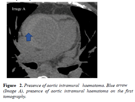 current-trends-cardiology-aortic