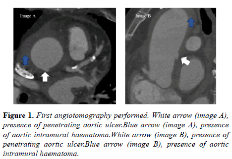 current-trends-cardiology-arrow