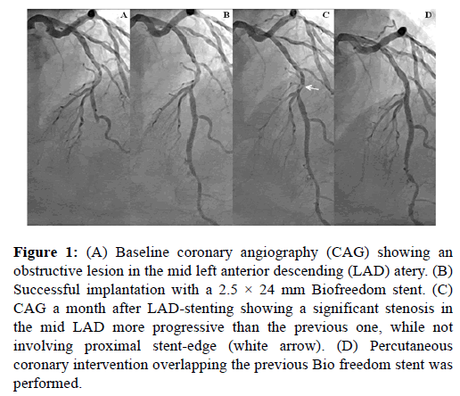 current-trends-cardiology-coronary-intervention