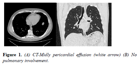 current-trends-cardiology-pericardial