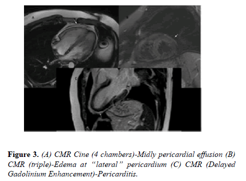 current-trends-cardiology-pericardium