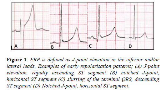 current-trends-cardiology-point-elevation